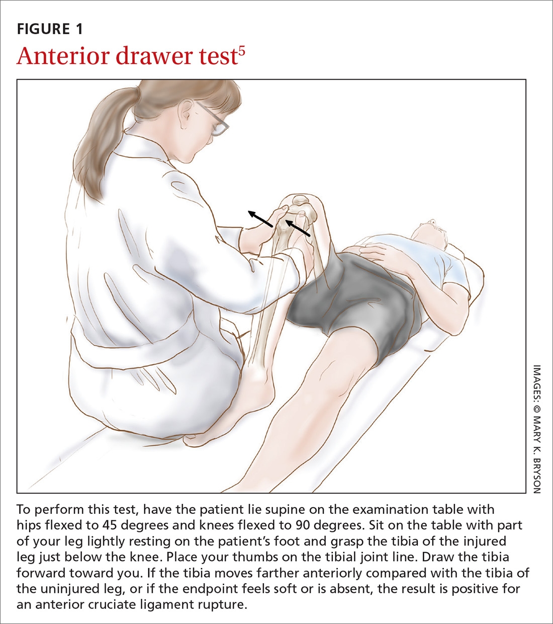 ACL Injury How Do The Physical Examination Tests Compare MDedge
