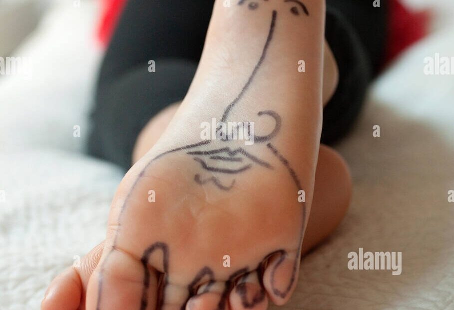 Detail Of Drawing Of A Face On The Bottom Of A Young Girl s Foot As She Rests In Bed Stock Photo Alamy