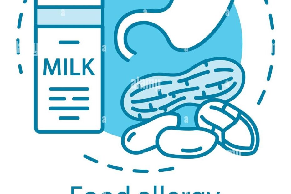 Food Allergy Concept Icon Allergic Reaction To Milk Proteins