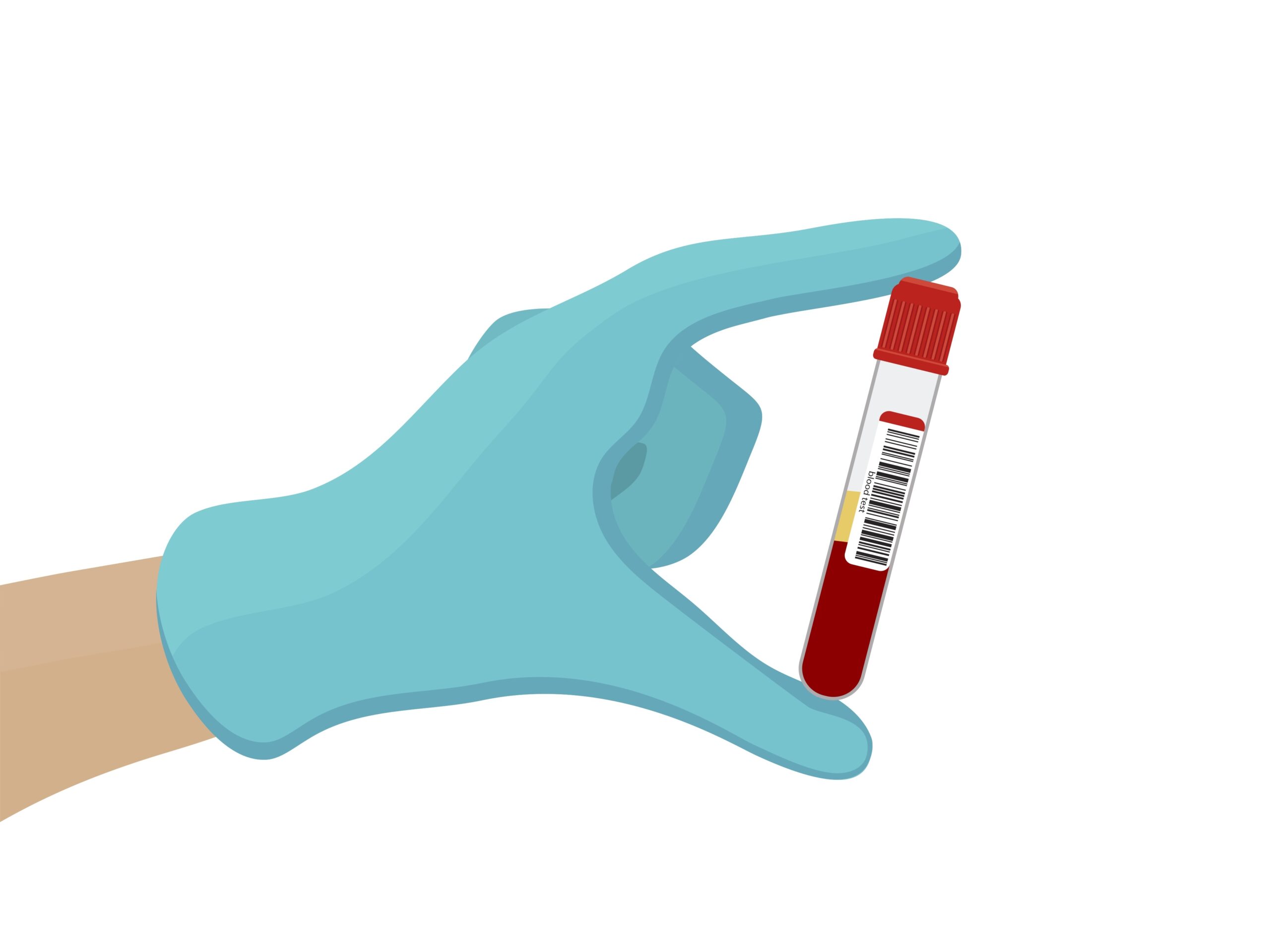 OVI Blood Test Results Thrown Out Where State Failed To Demonstrate Blood Draw Followed Proper Procedures Riddell Law LLC