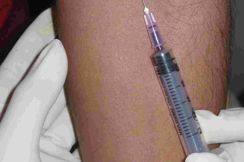 Patient Observed Sterile Treatment For Blood Tests Bloodborne HIV Don t Get Stuck
