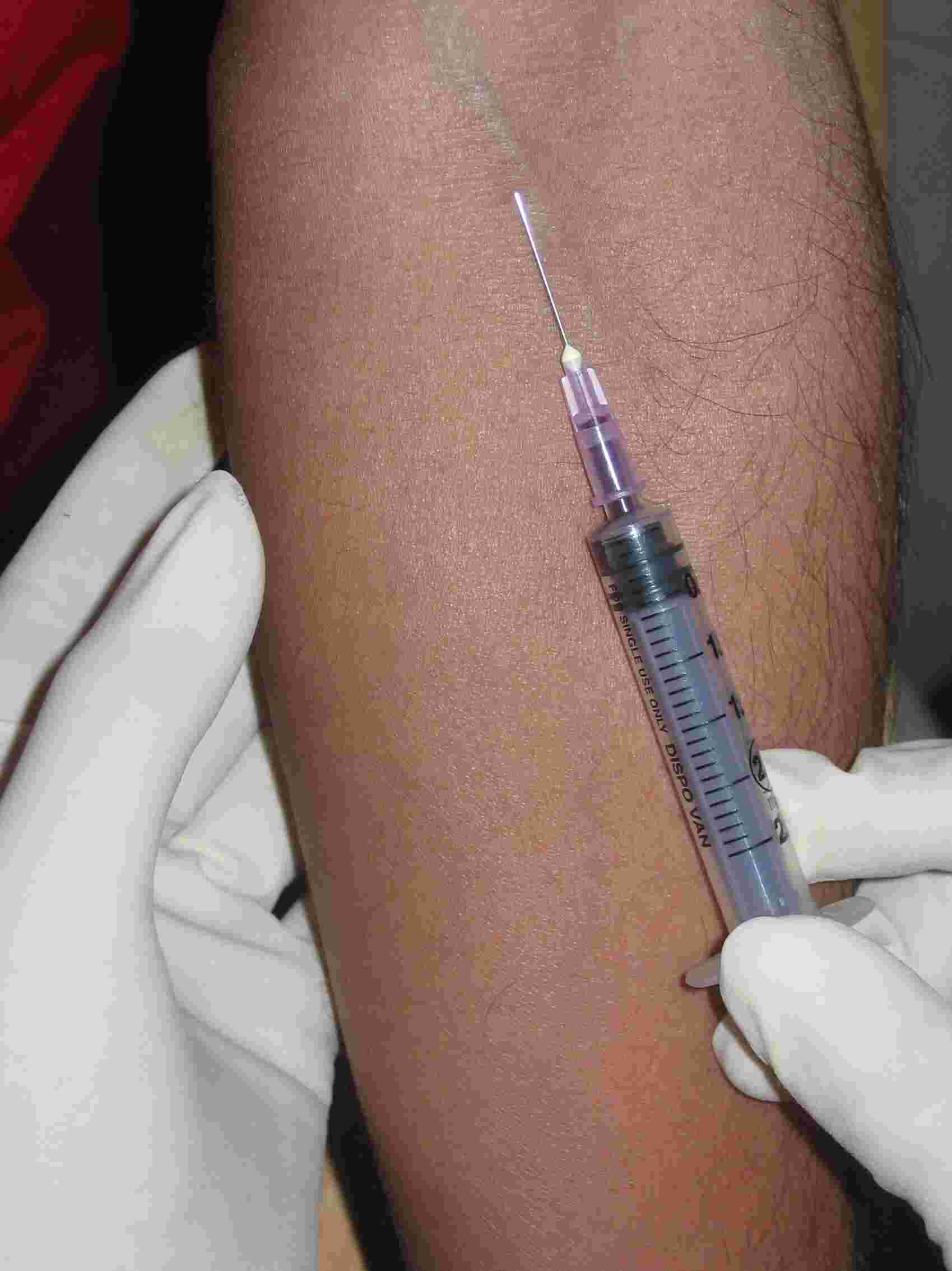 Patient Observed Sterile Treatment For Blood Tests Bloodborne HIV Don t Get Stuck 