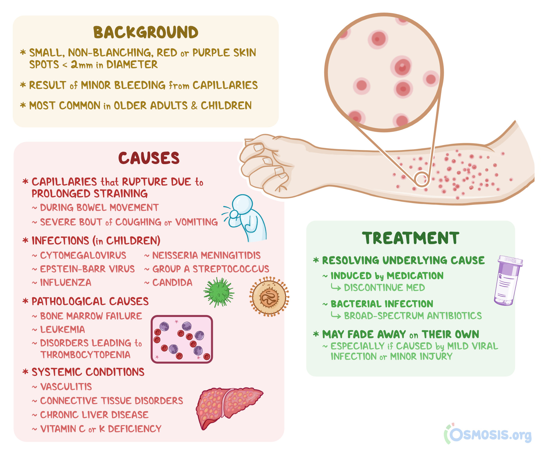 Petechiae Rash On Face Worries And Causes Osmosis