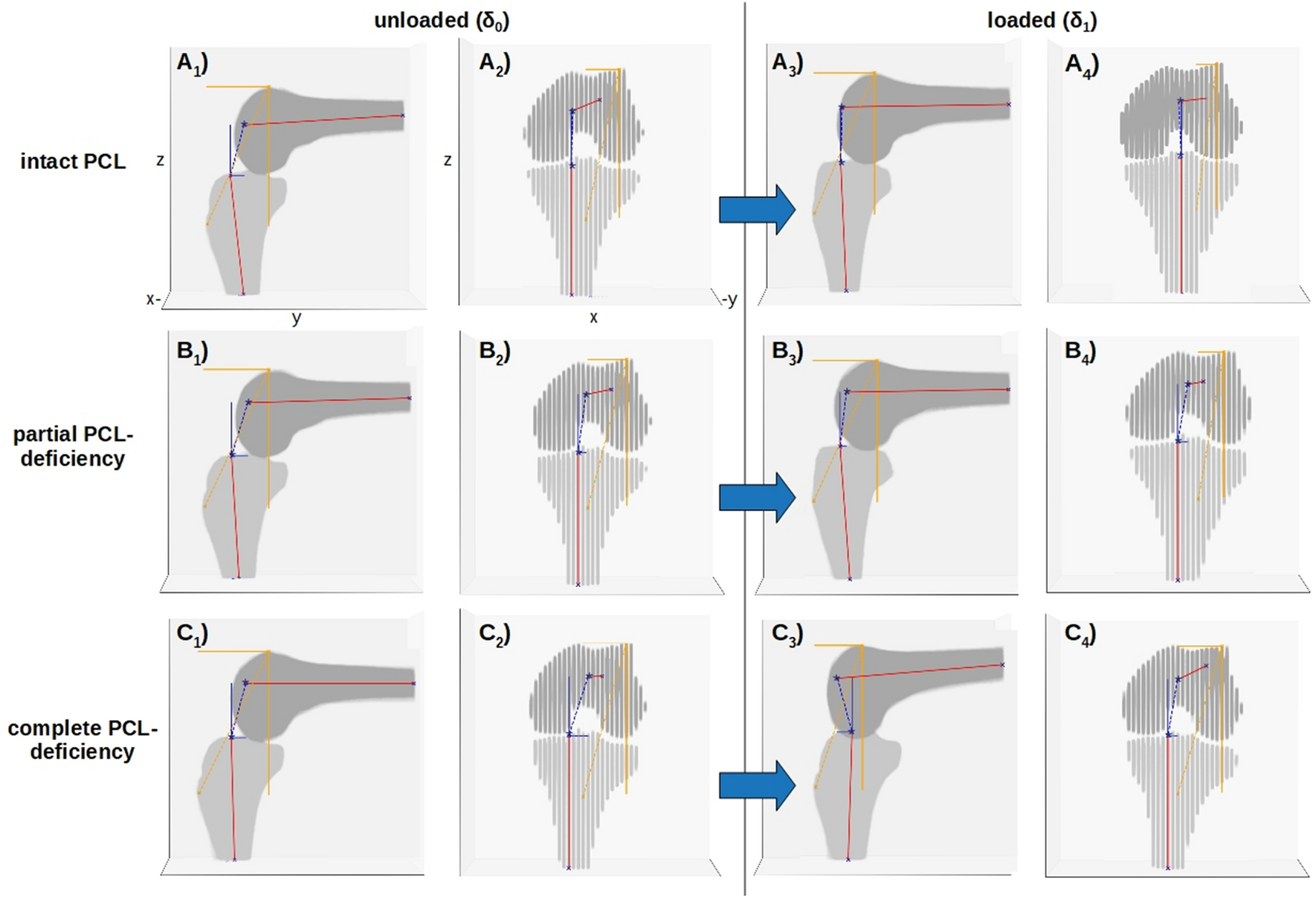 The MRI Posterior Drawer Test To Assess Posterior Cruciate Ligament Functionality And Knee Joint Laxity Scientific Reports