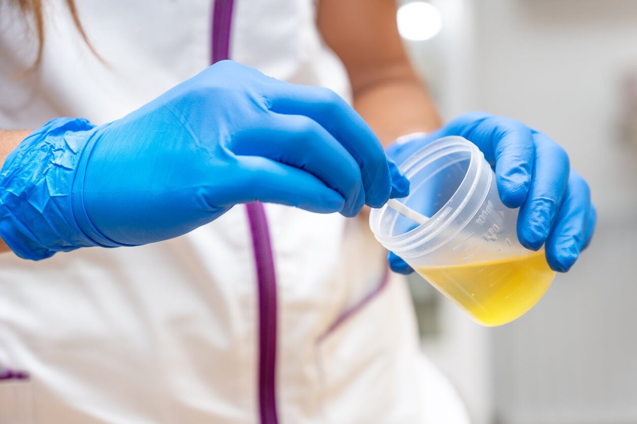 What Is Tested During A Urine Test For A DOT Physical SC 